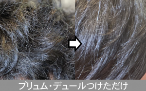 みたい 髪の毛 原因 陰毛 ザラザラの髪の毛を抜くのは危険。将来ハゲる危険性あり