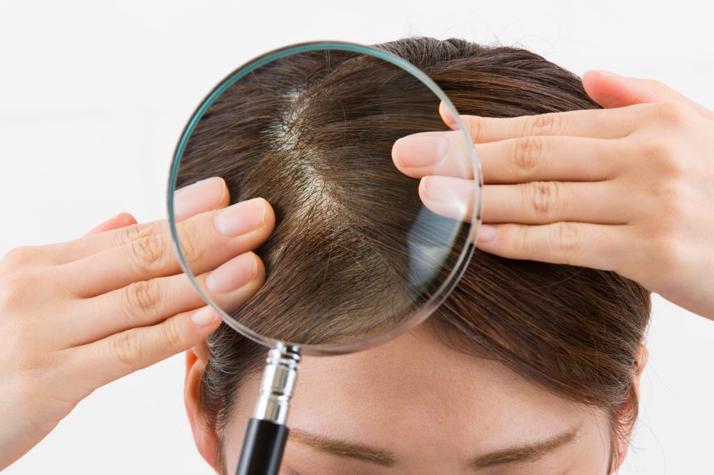シャンプーやカラーコンディショナーを使い続けて炎症が起きる場合は、髪質に合っていない証拠。